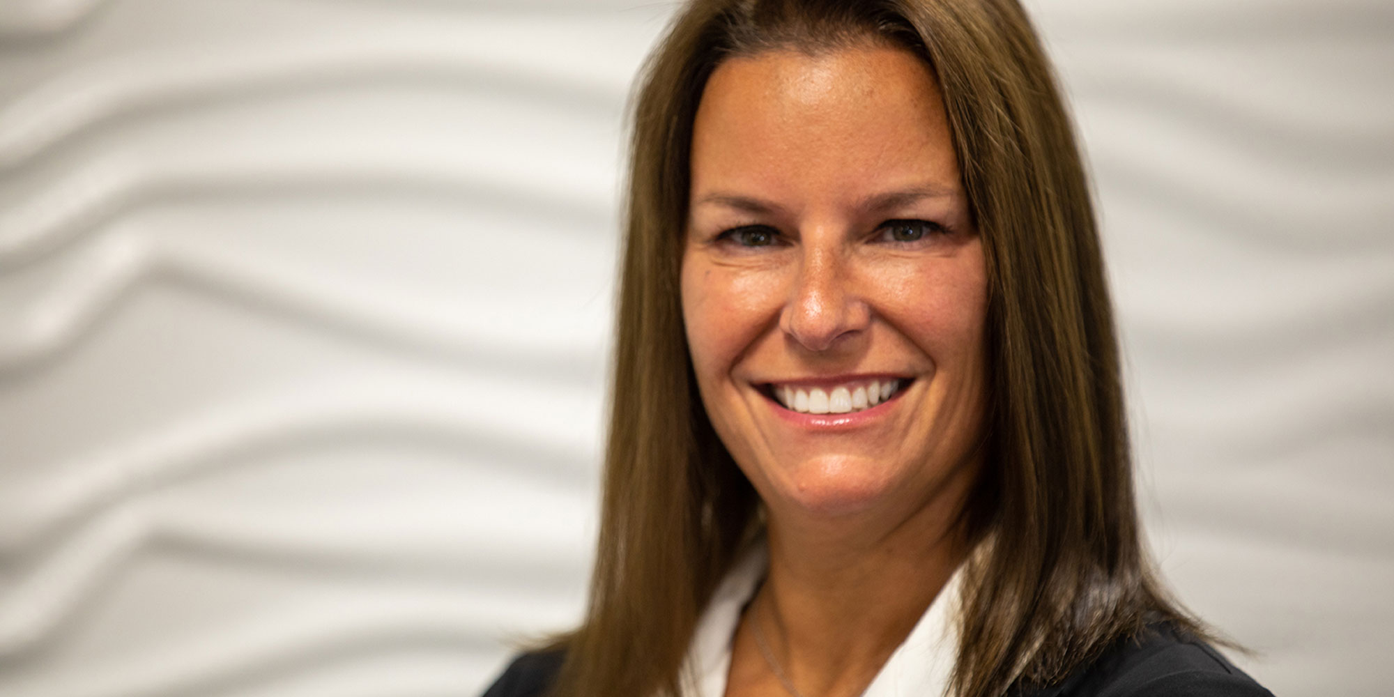 Unveiling the Benefits of Dental Implants in Marshfield, MA