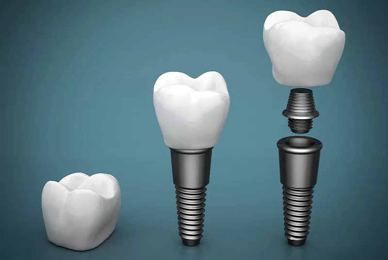 Toothache Image