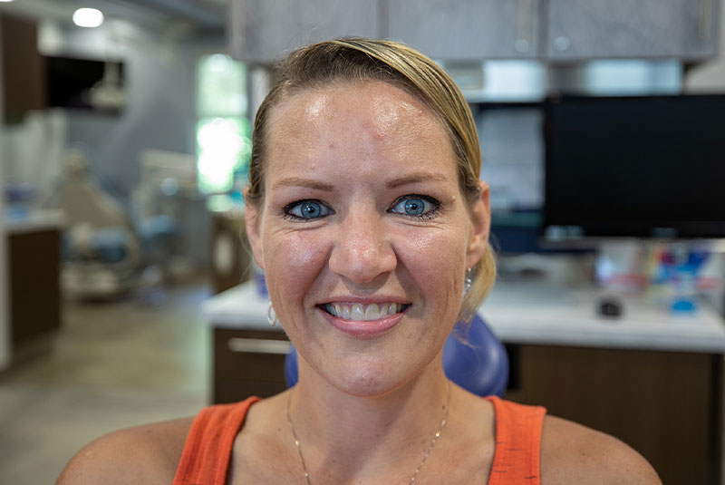 Victoria – Implants